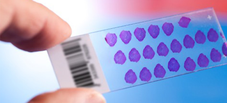 Mikrobiologisk stammebank