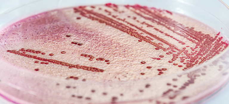 24-timers listeriaanalyse